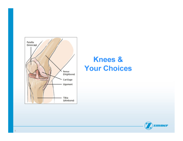 Slide 6- Knees & Your Choices